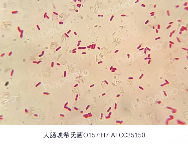 革兰氏染色镜检图——O157