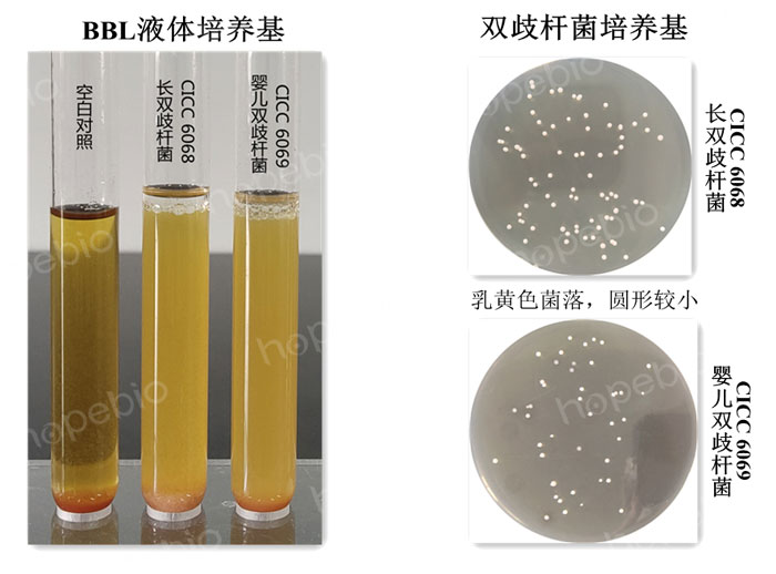 双歧杆菌在两种培养基上的生长特征