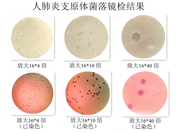 人肺炎支原体菌落镜检结果