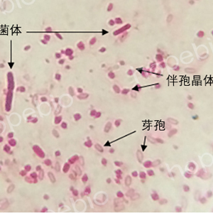 0.5%碱性复红溶液-生化-镜检-芽孢杆菌