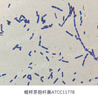 革兰氏染色镜检图——蜡样芽孢杆菌