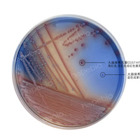 O157显色培养基——大肠埃希氏菌O157-大肠埃希氏菌