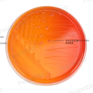 MAC-福氏志贺氏菌、大肠埃希氏菌、宋内志贺氏菌、痢疾志贺氏菌/